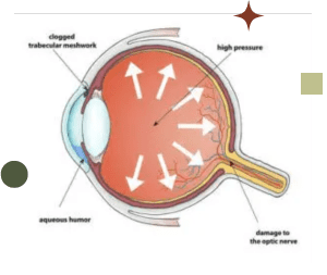 A diagram of an eye with arrows pointing to the right.